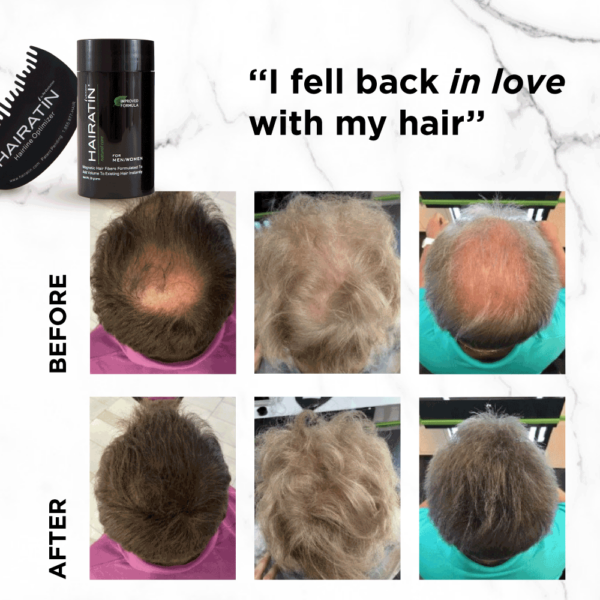 hairatin fibers best hair fibers for hair loss