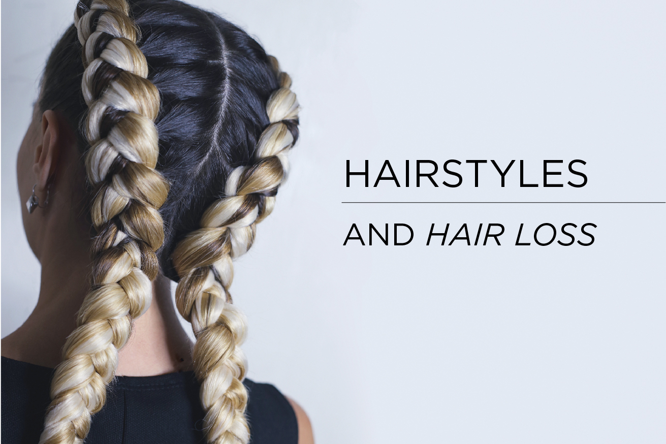 Everyday HairStyles to Prevent Female Hair Loss
