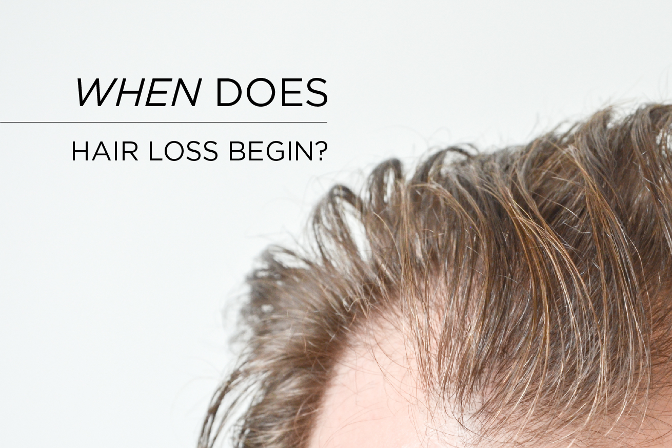 Hairatin | When Do Men Start Losing Hair? : Hairatin®