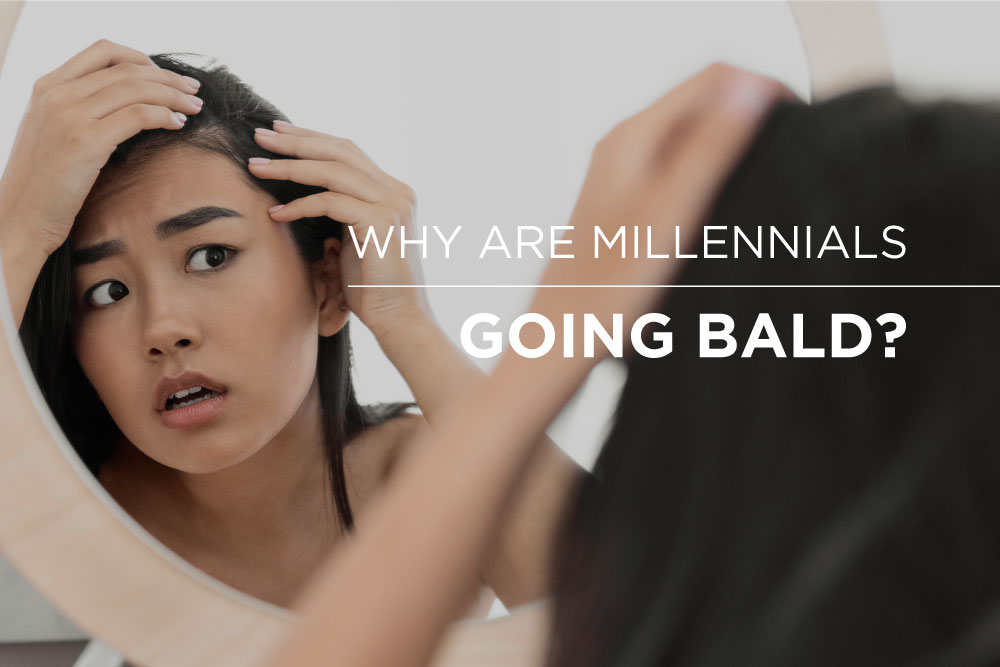 millennials going bald hair loss