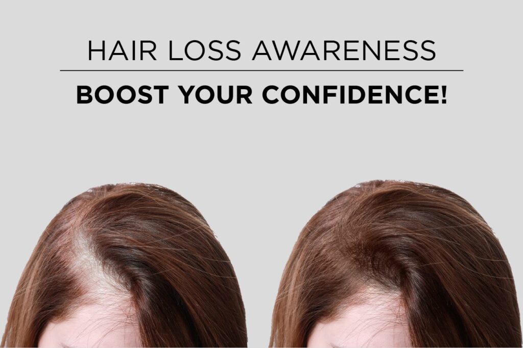 hair loss awareness thinning hair hairatin best hair fibers