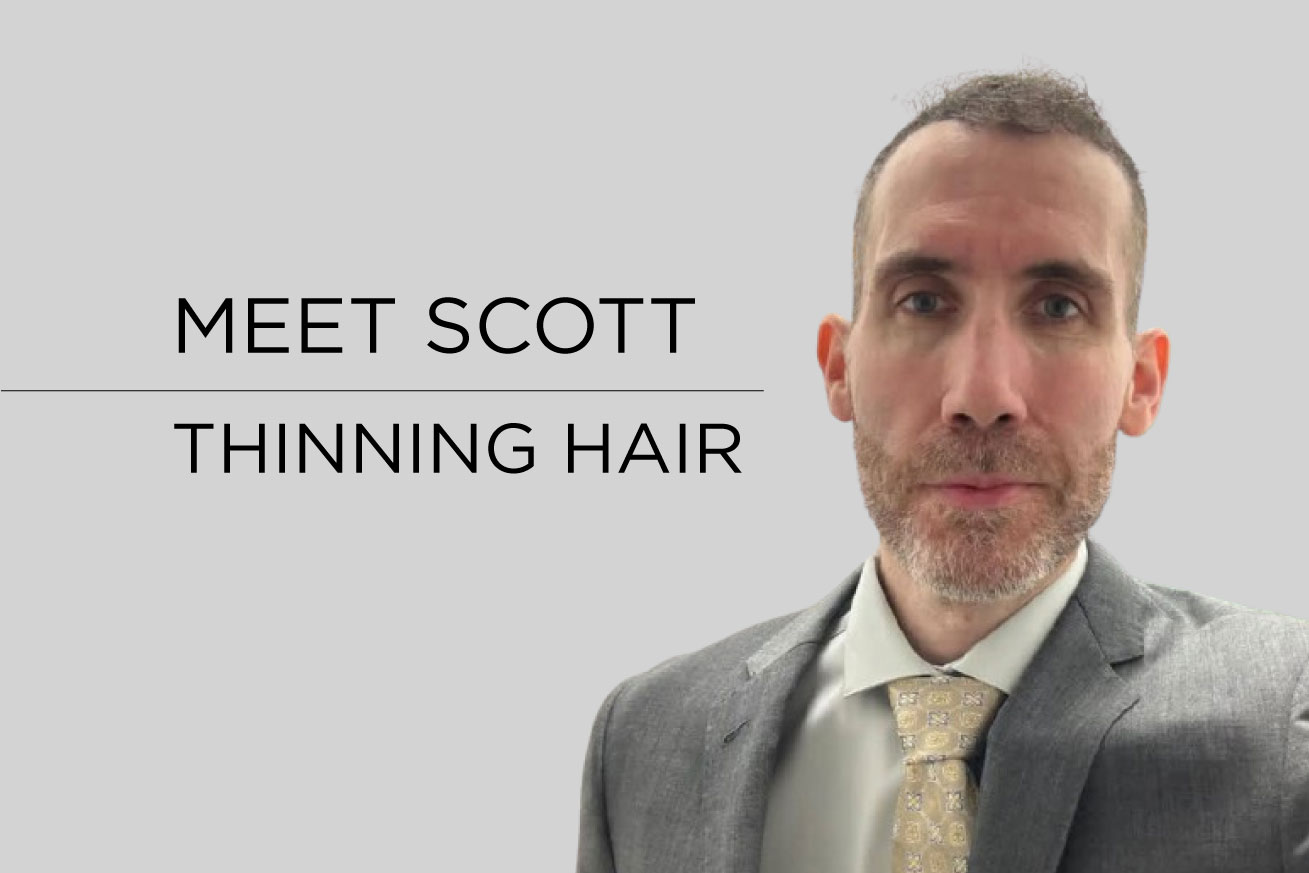 Thinning Hair in Men: Scott’s Journey