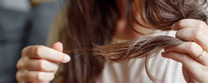 hair loss during pregnancy