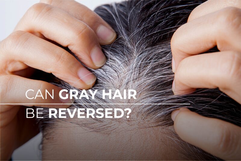 Can Gray Hair be Reversed?