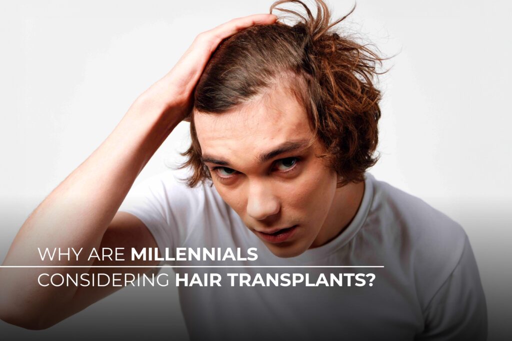 Why are millennials considering hair transplants?