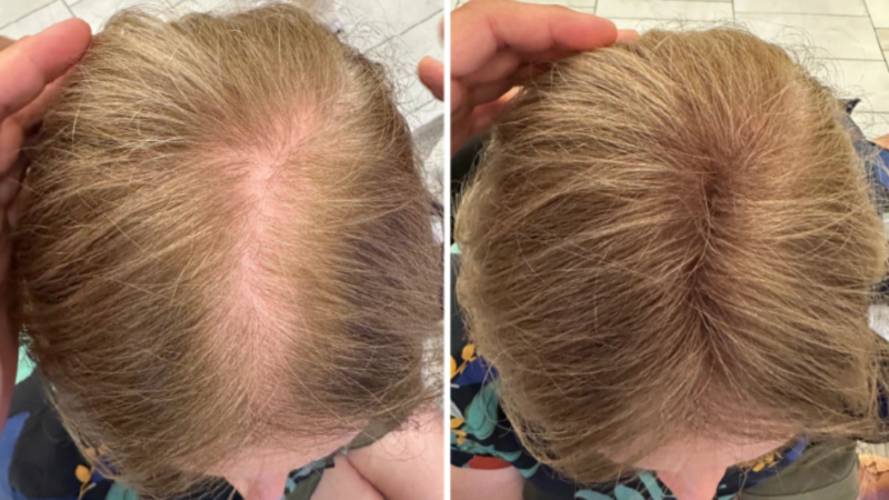Premium Hair Fibers: What Makes Hairatin Different?