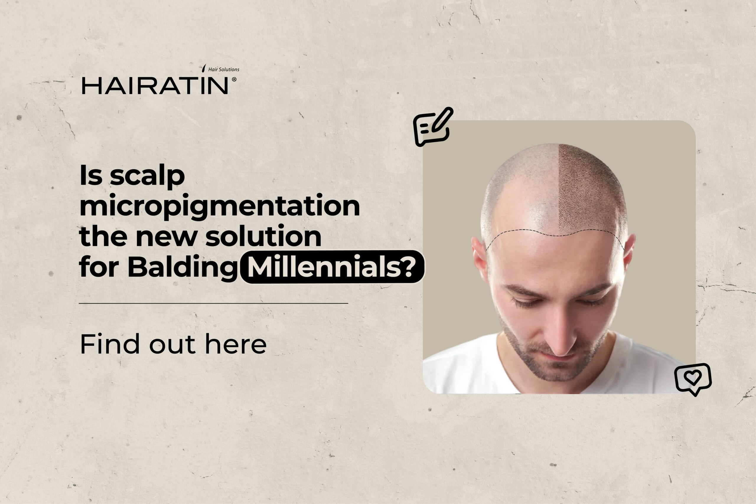 Scalp micropigmantation on millennials